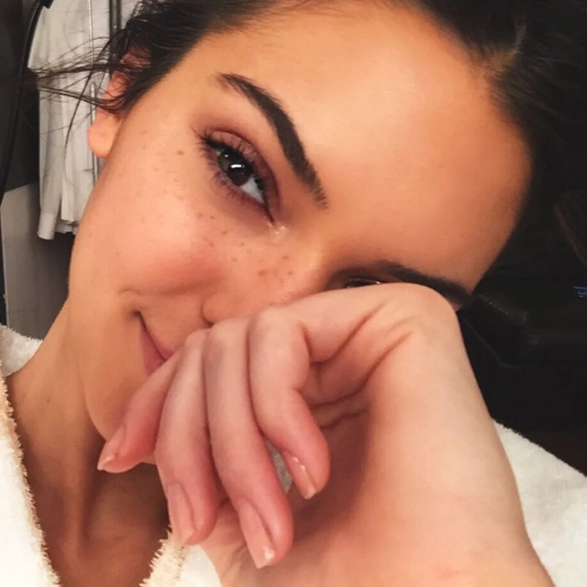 Κι η Kendall Jenner εμπιστεύεται το PDRN
